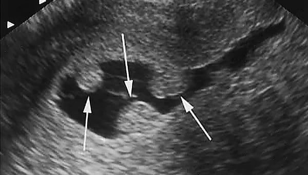 Ginecología y obstetricia en Saltillo Coahuila